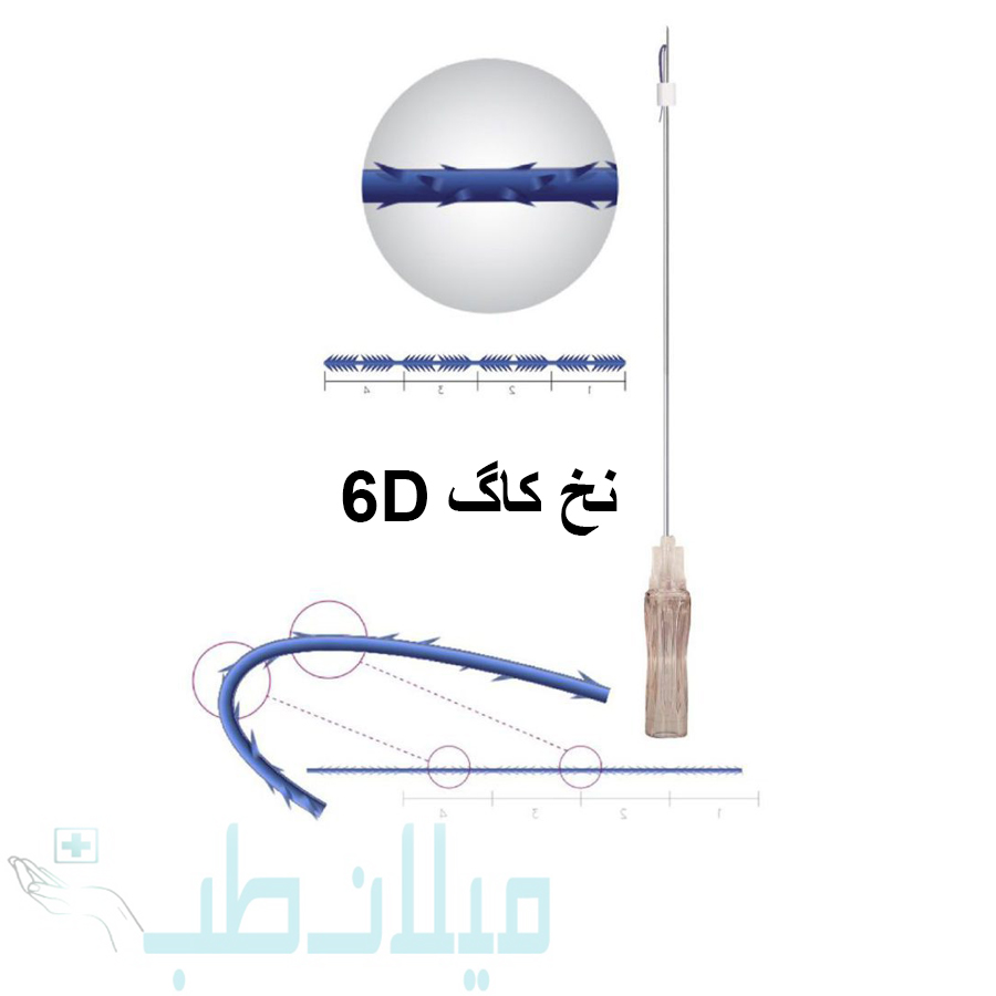نخ لیفت برند مدیلیفت مدل کاگ 6D سایز G19.100mm